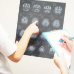 中耳炎の検査でレントゲン